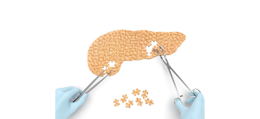 ДИФФУЗНЫЕ ИЗМЕНЕНИЯ